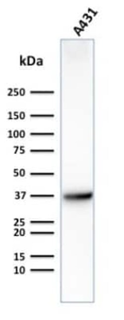 Glut1 Antibody (GLUT1/2475), Novus Biologicals:Antibodies:Primary Antibodies