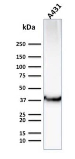 Glut1 Antibody (GLUT1/2476), Novus Biologicals 20 &mu;g; Unconjugated:Antikörper