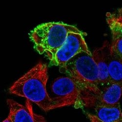 Glut1 Antibody, Novus Biologicals 100&mu;L; Unlabeled:Antibodies, Polyclonal