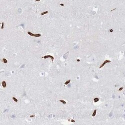 Glut1 Antibody, Novus Biologicals 25 &mu;L | Buy Online | Novus Biologicals | Fisher Scientific