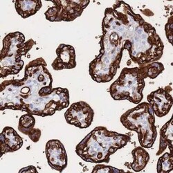 Glut1 Antibody, Novus Biologicals 25 &mu;L | Buy Online | Novus Biologicals | Fisher Scientific