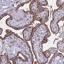Glut1 Antibody, Novus Biologicals 100&mu;L; Unlabeled:Antibodies, Polyclonal