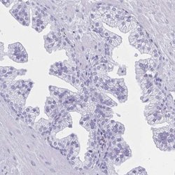 Glut1 Antibody, Novus Biologicals 100&mu;L; Unlabeled:Antibodies, Polyclonal