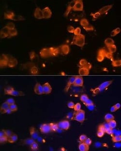 Glut2 Rabbit anti-Human, Mouse, Rat, Clone: 2V2U2, Novus Biologicals 20 &mu;g | Buy Online | Bio-Techne | Fisher Scientific