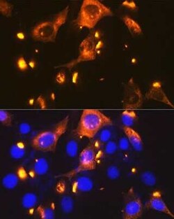 Glut2 Rabbit anti-Human, Mouse, Rat, Clone: 2V2U2, Novus Biologicals 20 &mu;g | Buy Online | Bio-Techne | Fisher Scientific