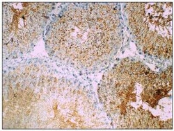 Glut3 Antibody, Novus Biologicals 100 &mu;g; Unconjugated:Antibodies, Polyclonal