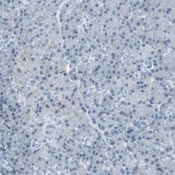 Glut5 Antibody, Novus Biologicals 0.1 mL | Buy Online | Novus Biologicals | Fisher Scientific