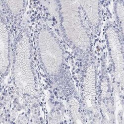 Glut5 Rabbit anti-Human, Polyclonal, Novus Biologicals 25 &mu;g; Unconjugated:Antibodies,