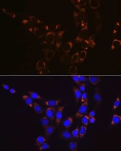 Glutamate Dehydrogenase Rabbit anti-Human, Mouse, Rat, Clone: 7L7N2, Novus Biologicals 100 &mu;g | Buy Online | Novus Biologicals | Fisher Scientific