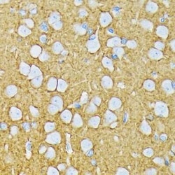 Glutamate Receptor 6 Rabbit anti-Human, Mouse, Rat, Clone: 4B4L9, Novus
