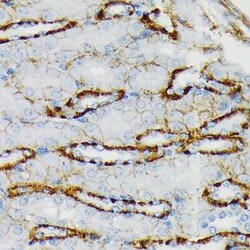 Glutamate Receptor 6 Rabbit anti-Human, Mouse, Rat, Clone: 4B4L9, Novus