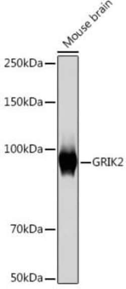 Glutamate Receptor 6 Rabbit anti-Human, Mouse, Rat, Clone: 4B4L9, Novus