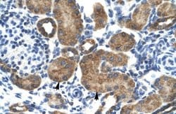 Glutamate Receptor 6 Antibody, Novus Biologicals 100 &mu;L; Unconjugated:Antibodies,