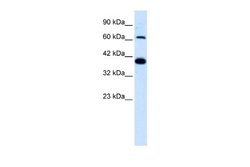 Glutamate Receptor 6 Antibody, Novus Biologicals 100 &mu;L; Unconjugated:Antibodies,