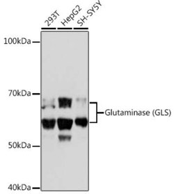 Glutaminase Rabbit anti-Human, Clone: 8R8J6, Novus Biologicals 100 &mu;g | Buy Online | Novus Biologicals | Fisher Scientific