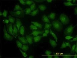 Glutaminase Antibody (5C4), Novus Biologicals 0.1 mg | Buy Online | Novus Biologicals | Fisher Scientific