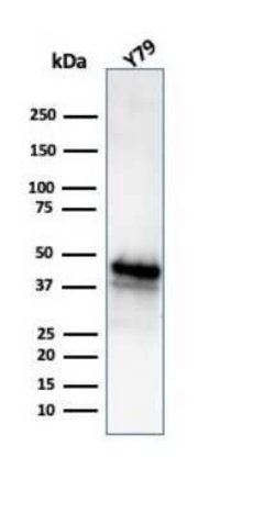 Glutamine Synthetase Mouse anti-Human, Clone: GLUL/6604, Novus Biologicals