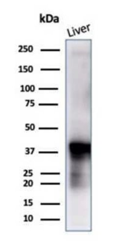 Glutamine Synthetase Mouse anti-Human, Clone: GLUL/6604, Novus Biologicals