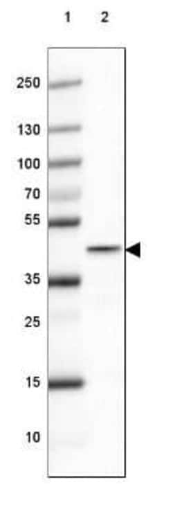 Glutamine Synthetase Antibody (CL2999), Novus Biologicals 25 &mu;L, Unconjugated:Antibodies,