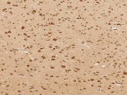 Glutaminyl-peptide Cyclotransferase/QPCT Antibody, Novus Biologicals:Antibodies:Primary