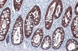 Glutathione Peroxidase 2/GPX2 Antibody (HL125), Novus Biologicals 100 &mu;g;
