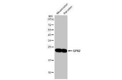 Glutathione Peroxidase 2/GPX2 Antibody (HL125), Novus Biologicals 100 &mu;g;