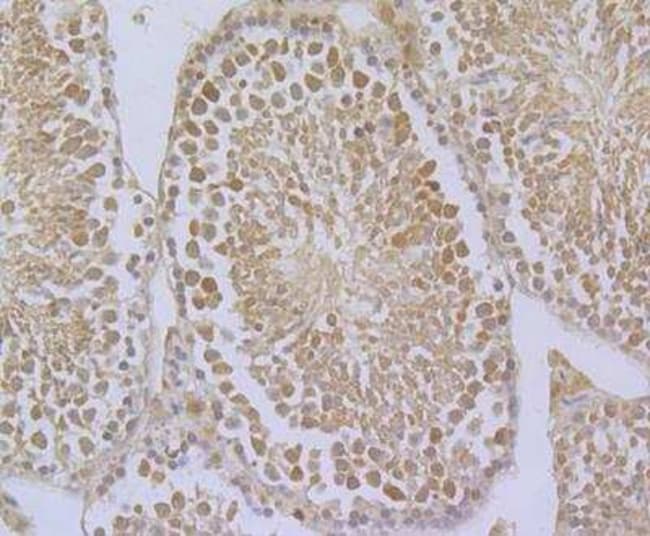 glutathione peroxidase 4 antibody Anti-Glutathione Peroxidase 4 Antibody [1B4]