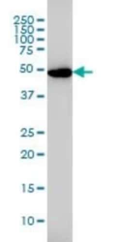 Glutathione Reductase Antibody (6B4), Novus Biologicals 0.1 mg, Unconjugated:Antibodies,