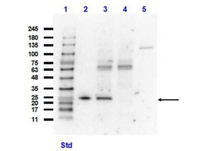 glutathione suppositories skin lightening reviews AffiELISA® Human GSTm1 (Glutathione S Transferase Mu 1) E