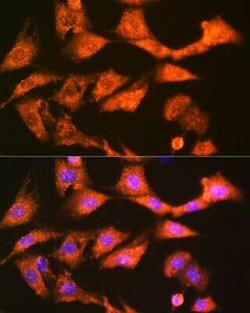 Glutathione S Transferase kappa 1 Rabbit anti-Human, Mouse, Clone: 7J5B3,