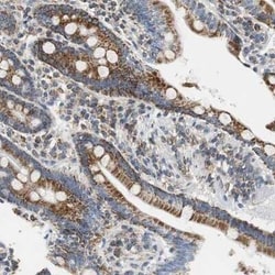 Glutathione S Transferase kappa 1 Antibody, Novus Biologicals 25 &mu;L | Buy Online | Novus Biologicals | Fisher Scientific