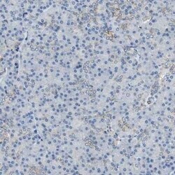 Glutathione S Transferase kappa 1 Antibody, Novus Biologicals 25 &mu;L | Buy Online | Novus Biologicals | Fisher Scientific