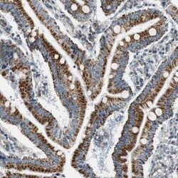 Glutathione S Transferase kappa 1 Antibody, Novus Biologicals 25 &mu;L | Buy Online | Novus Biologicals | Fisher Scientific