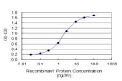 Glutathione S-Transferase pi 1/GSTP1 Antibody (2G6-F6), Novus Biologicals