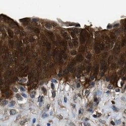 Glutathione S-Transferase pi 1/GSTP1 Antibody, Novus Biologicals 0.1 mL;