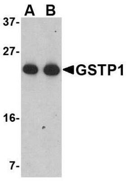 Glutathione S-Transferase pi 1/GSTP1 Antibody - BSA Free, Novus Biologicals 0.025 mg | Buy Online | Novus Biologicals | Fisher Scientific