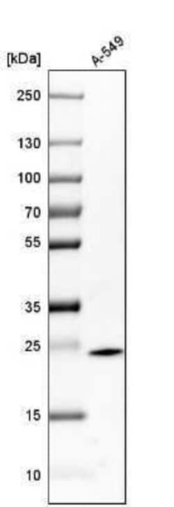 Glutathione S-Transferase pi 1/GSTP1 Antibody, Novus Biologicals 0.1 mL;
