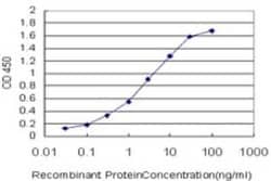 Glutathione S-transferase Mu 5 Antibody (1G4), Novus Biologicals 0.1 mg | Buy Online | Novus Biologicals | Fisher Scientific