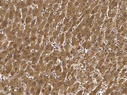 Glutathione S-transferase Mu 5 Antibody, Novus Biologicals 100 &mu;g, Unconjugated:Antibodies,