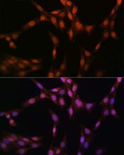 Glutathione Synthetase Rabbit anti-Human, Mouse, Rat, Clone: 2S9W7, Novus