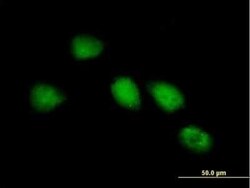 GlyBP Antibody, Novus Biologicals 0.05 mg | Buy Online | Novus Biologicals | Fisher Scientific
