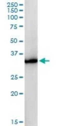 Glycerol 3 Phosphate Dehydrogenase Antibody (3C10-1C4), Novus Biologicals 0.1 mg | Buy Online | Novus Biologicals | Fisher Scientific