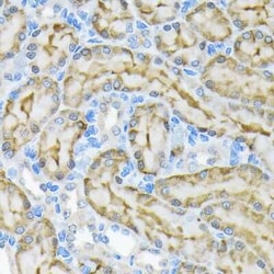 Glycerol Kinase Rabbit anti-Human, Mouse, Rat, Clone: 8S4T8, Novus Biologicals:Antibodies:Primary