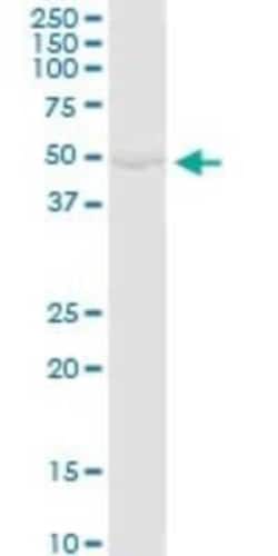 Glycerol Kinase Antibody, Novus Biologicals 0.1 mg | Buy Online | Novus Biologicals | Fisher Scientific