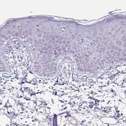 Glycogen phosphorylase, muscle form Antibody, Novus Biologicals 25 &mu;L,