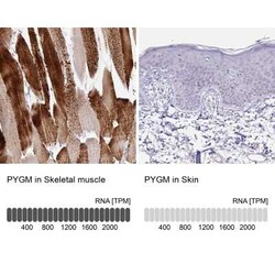 Glycogen phosphorylase, muscle form Antibody, Novus Biologicals 25 &mu;L,