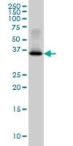 Glycogenin 1 Antibody (3B5), Novus Biologicals 0.1 mg | Buy Online | Novus Biologicals | Fisher Scientific