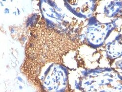 Glycophorin A Antibody (GYPA/280), Novus Biologicals:Antibodies:Primary