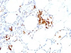 Glycophorin A Antibody (GYPA/280), Novus Biologicals:Antibodies:Primary