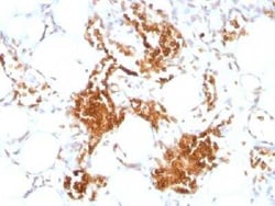 Glycophorin A Antibody (SPM599), Novus Biologicals:Antibodies:Primary Antibodies